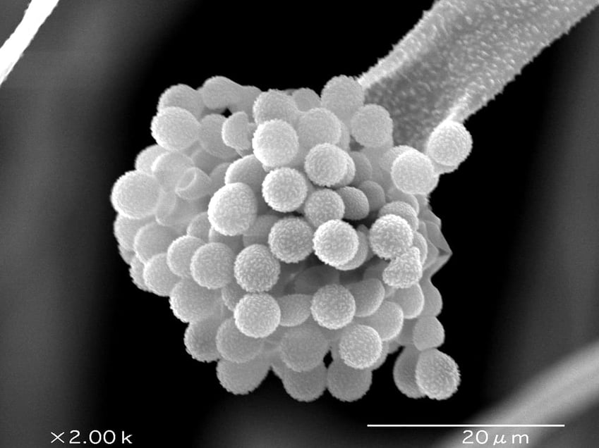 A microscopic image of koji fungus, which plays a vital role in the production of fermented foods (Photo courtesy of the National Research Institute of Brewing)
